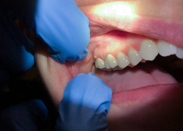 Best Pediatric Emergency Dentist in Silverton, OH