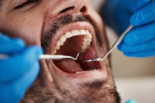 Best Broken or Cracked Tooth Emergency Dentist in Silverton, OH